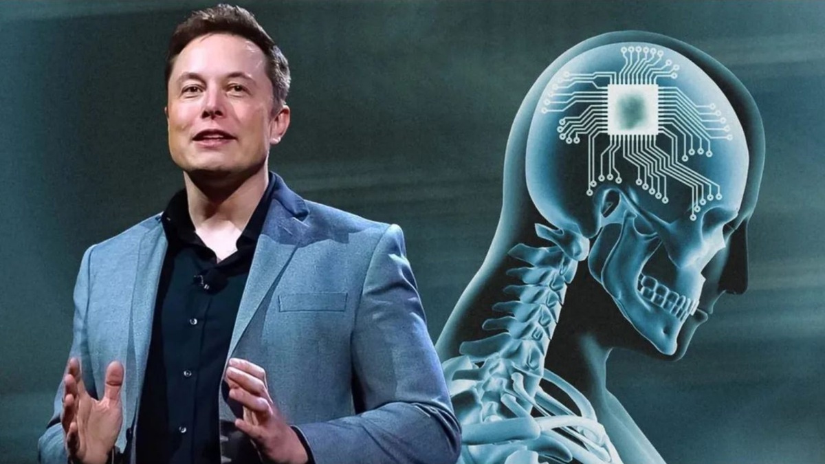 Neuralink của Elon Musk phát hiện sự cố sau ca cấy chip vào não người