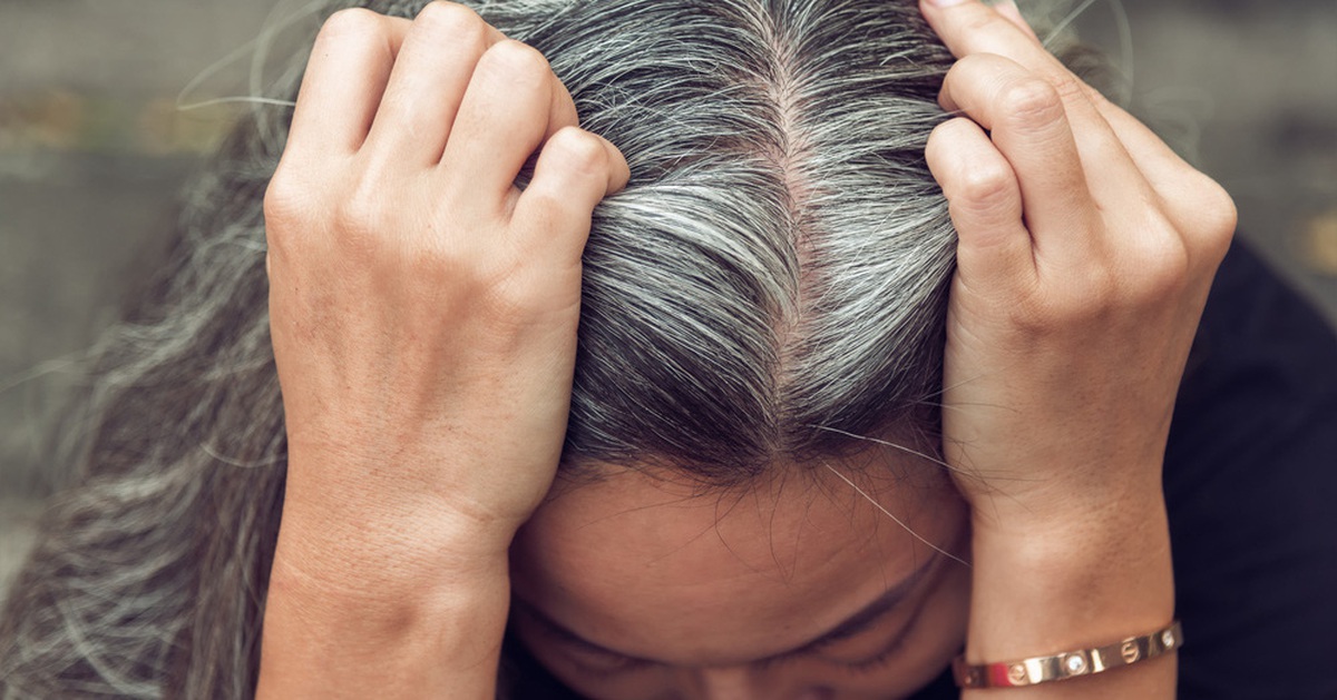 Căng thẳng có khiến tóc bạc đi?
