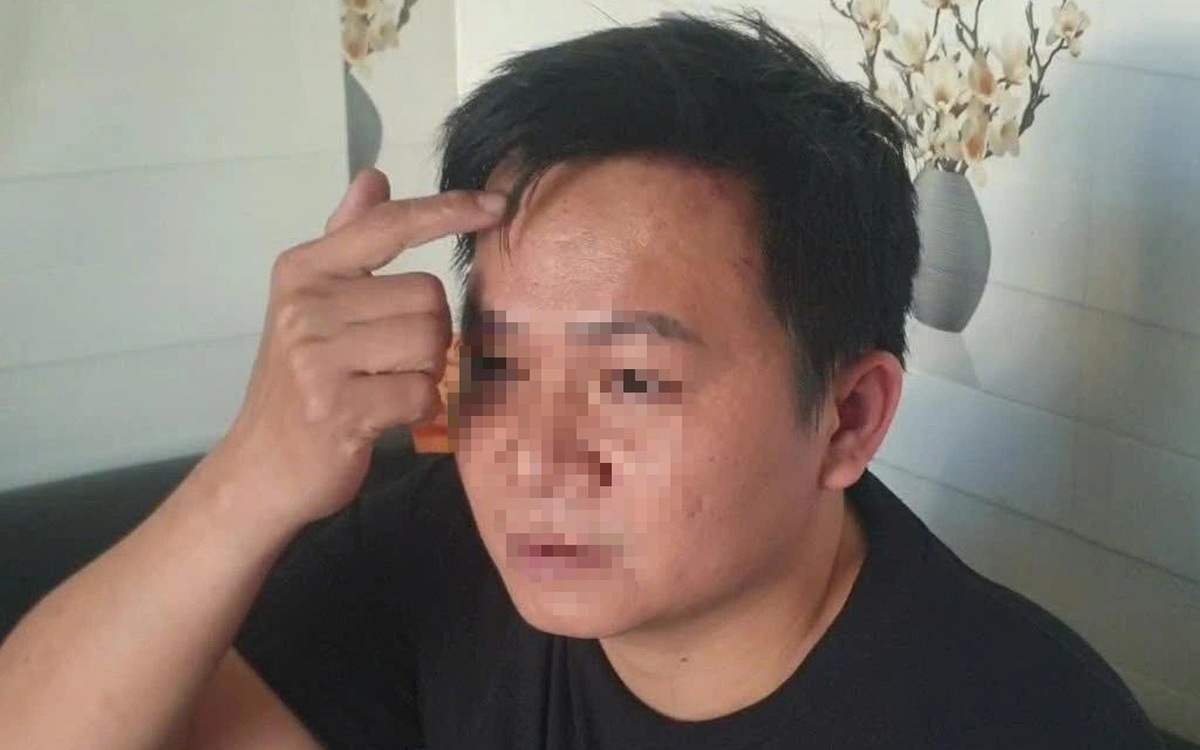 Camera ghi cảnh tài xế công nghệ bị đánh trước cửa nhà ở Bình Dương