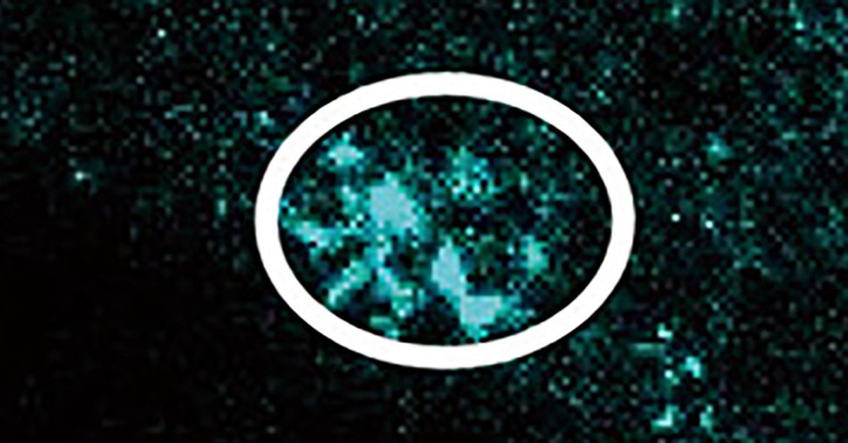 Phát hiện vi nhựa có thể chặn lưu thông máu trong não