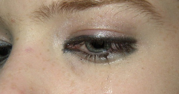 Mắt quá khô có thể gây ra chảy nước mắt sống không?
