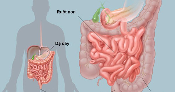 Nguyên nhân đau bụng không rõ nguyên nhân và cách điều trị hiệu quả