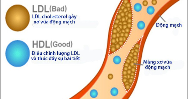 HDL được coi là mỡ máu tốt vì lí do gì?
