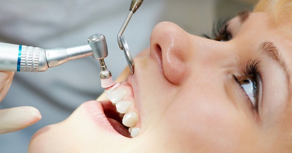  Không lấy cao răng có sao không - Bí quyết chăm sóc răng miệng hiệu quả