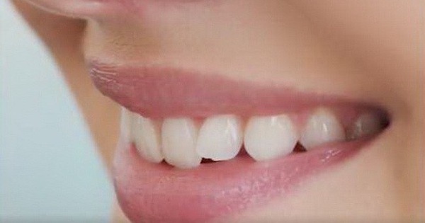 Răng nanh có tác dụng gì trong việc nâng đỡ cung răng?
