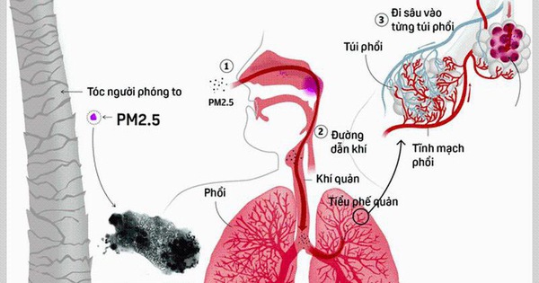 Làm thế nào ô nhiễm không khí ảnh hưởng đến hệ hô hấp của con người?
