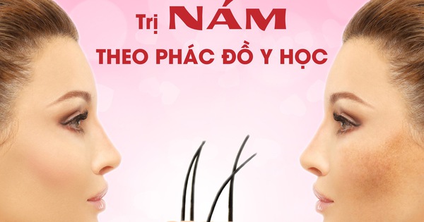 Tìm hiểu về sách điều trị nám khoa học và những phương pháp mới