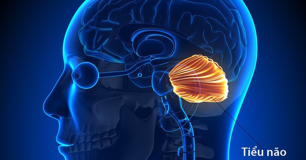 Những triệu chứng chính của bệnh teo tiểu não là gì?
