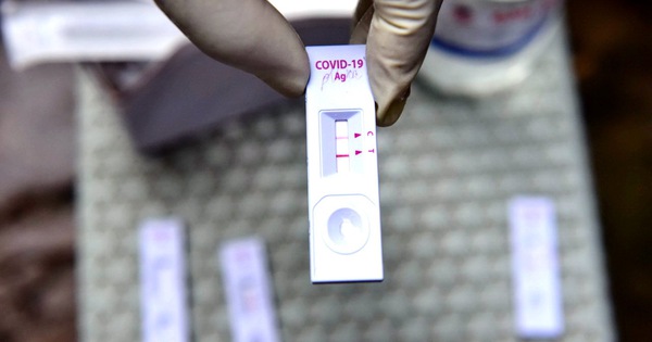 Test nhanh COVID-19: Vạch đậm - nhạt có thể hiện bệnh nặng - nhẹ?