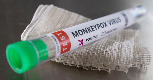UK monitors monkeypox, Denmark has its first case