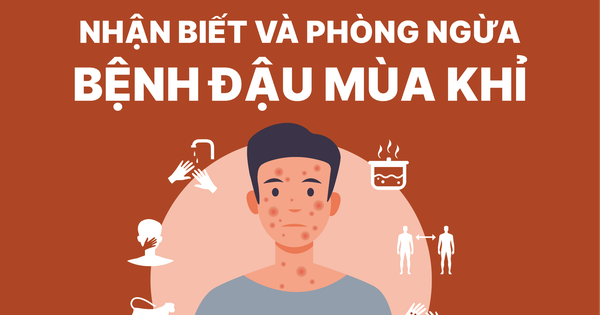 Tại sao bệnh đậu mùa khỉ thường xuất hiện vào mùa thu và đông?
