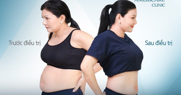 Trung tâm giảm béo Americare áp dụng phương pháp gì để giảm mỡ bụng trong 25 phút?
