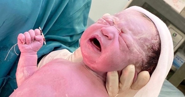 6月14日の朝のニュース: IUDを手に持って生まれた2人の新生児の興味深い画像