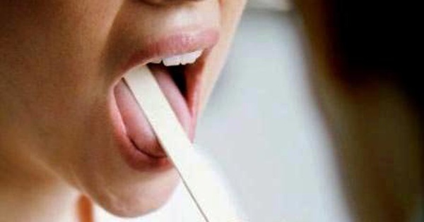  Miệng bị chát : Những nguyên nhân và cách khắc phục hiệu quả