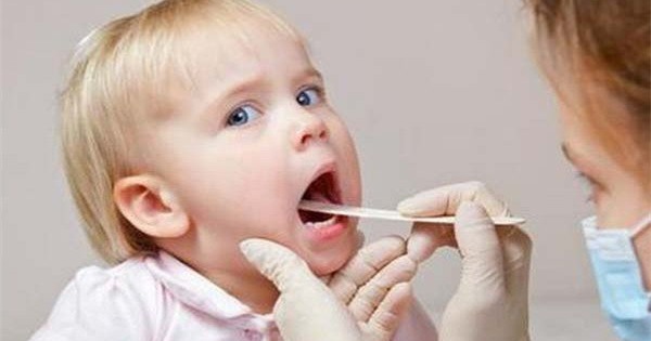 ​Bệnh lý viêm loét miệng ở trẻ