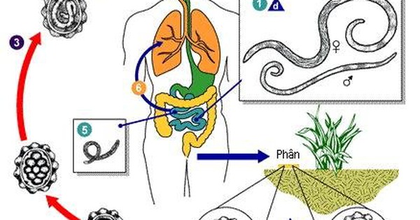 Các biện pháp phòng tránh giun chui ống mật nào? 
