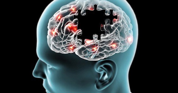 Có những thói quen tốt nào giúp giữ gìn sức khỏe để tránh bệnh Alzheimer?
